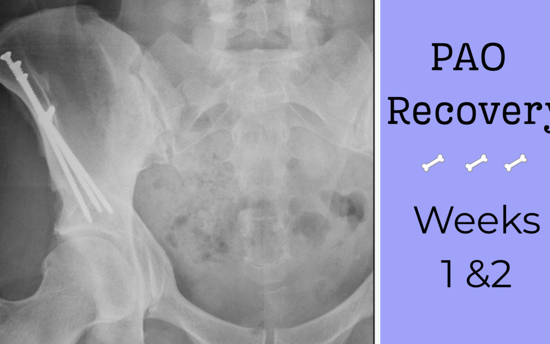 Navigating PAO Recovery: First Two Weeks Experience