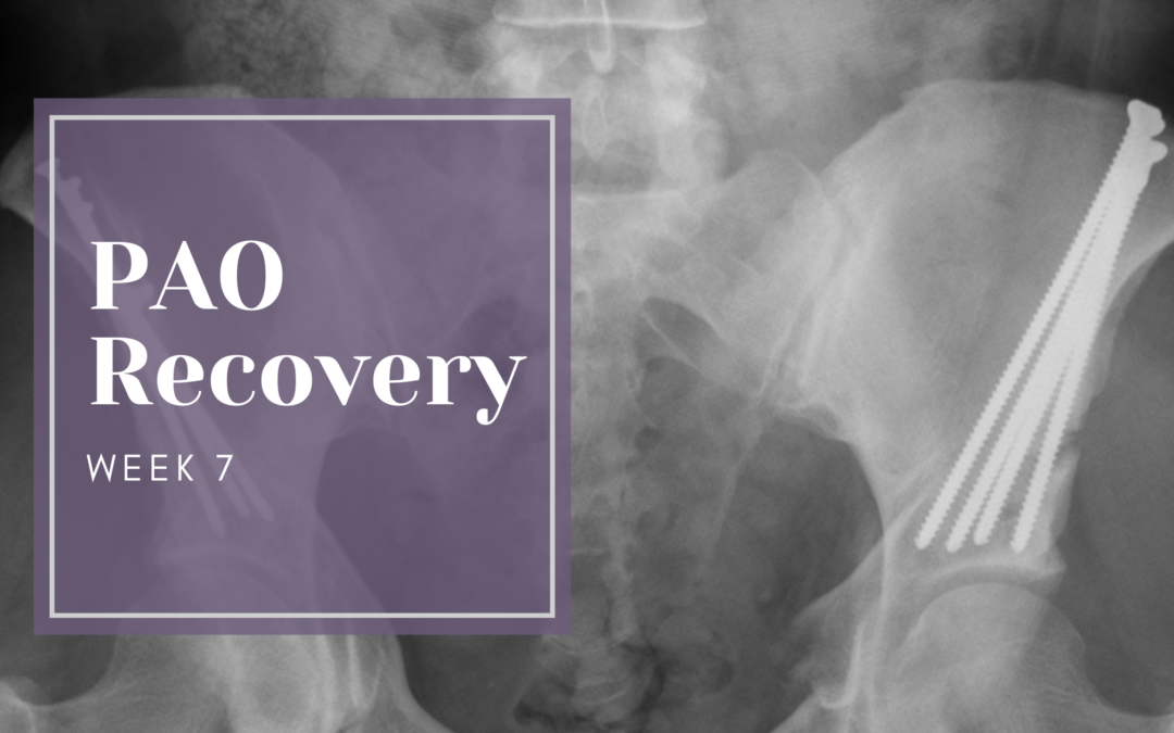 PAO Recovery Week 7: First Steps and Driving Again