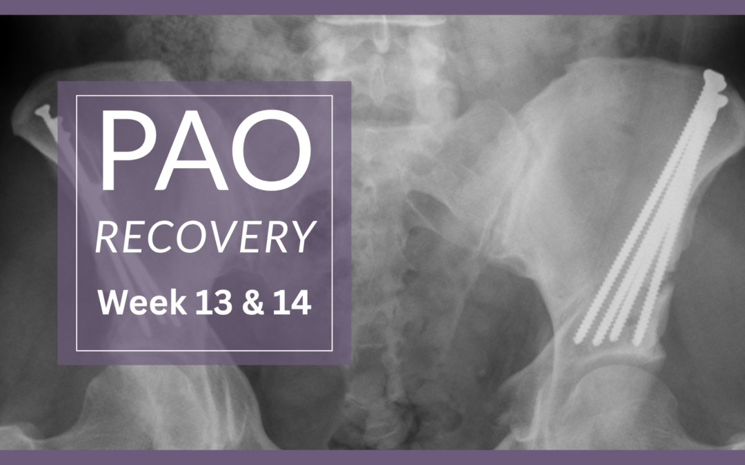 14 Weeks Post LPAO: Life, PT, Pain & Recovery Update